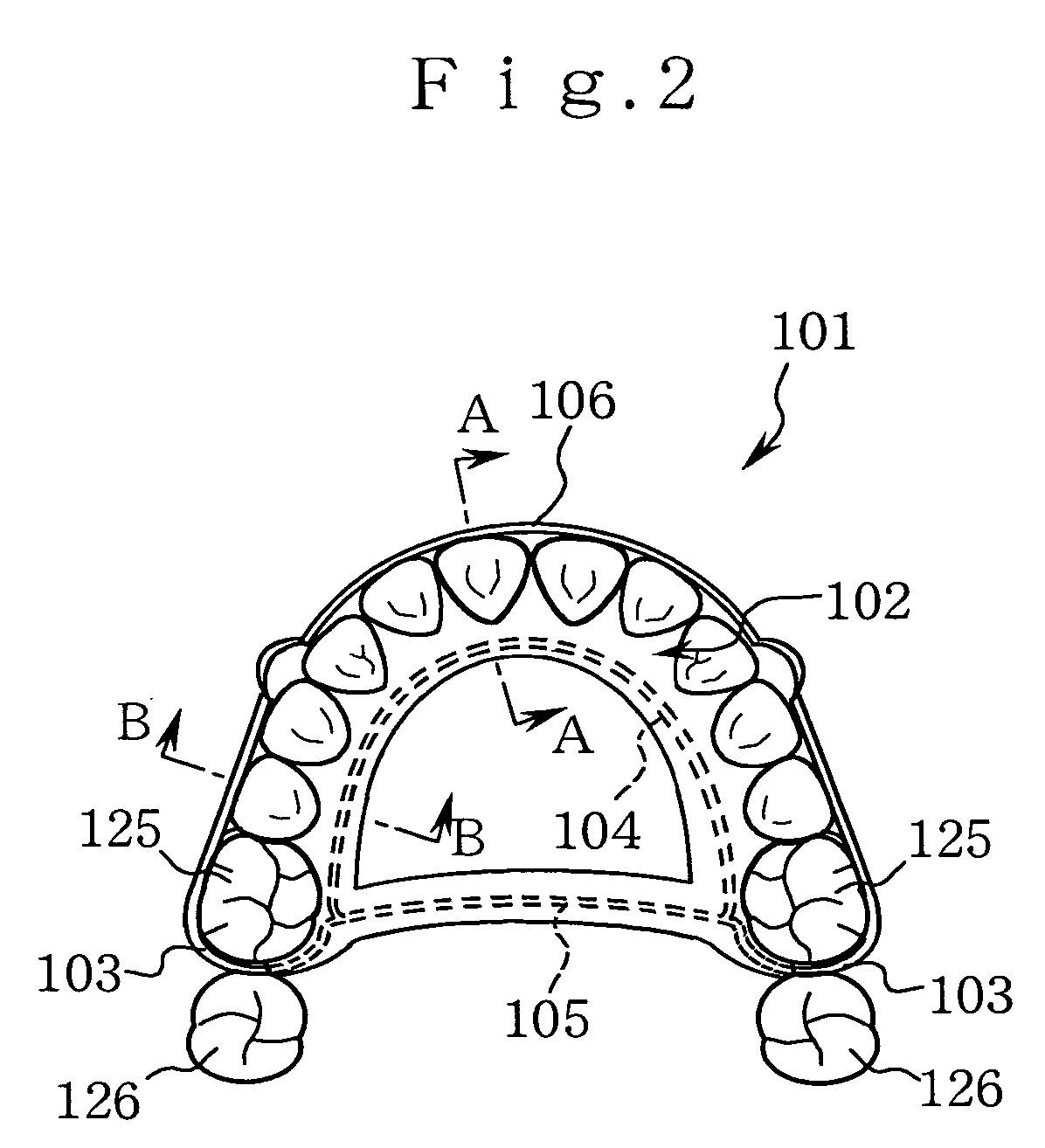 Orthodontic retainer