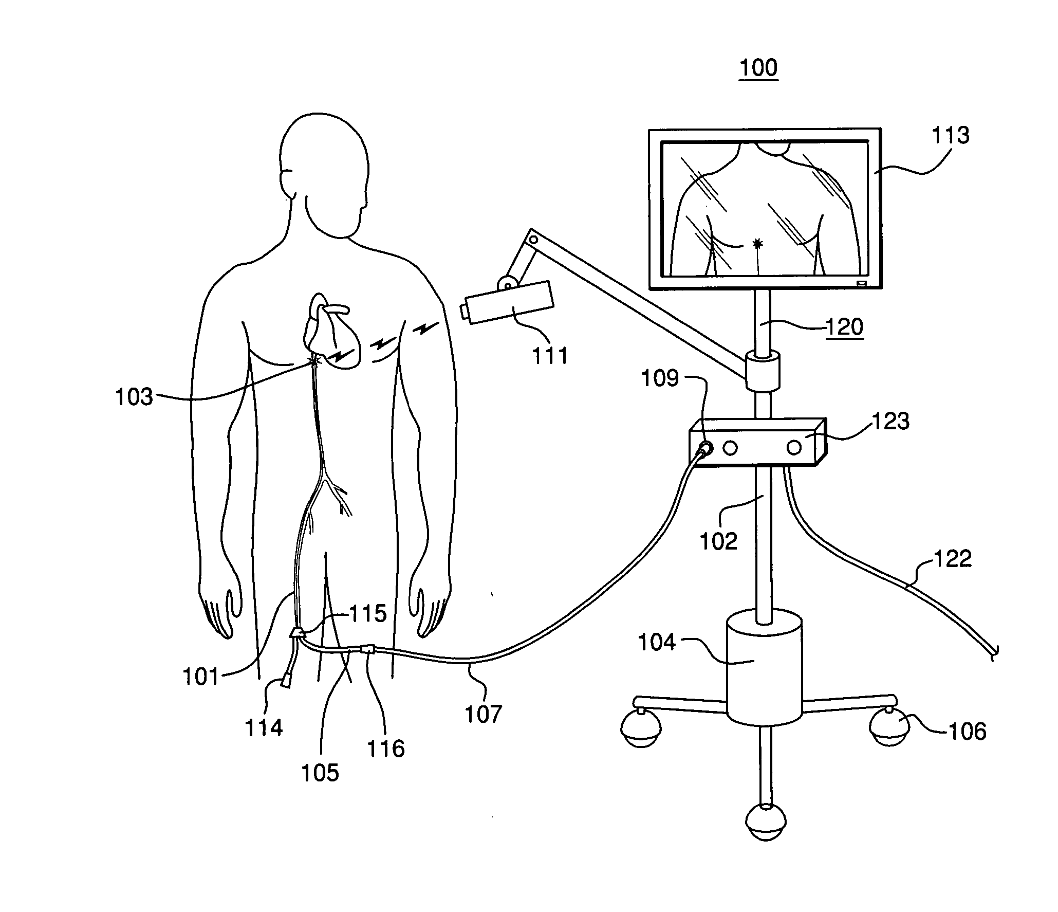 Optically guided system for precise placement of a medical catheter in a patient