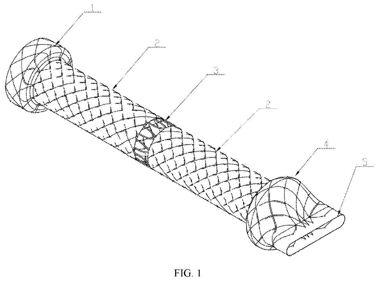 Ball-type anti-reflux biliary stent