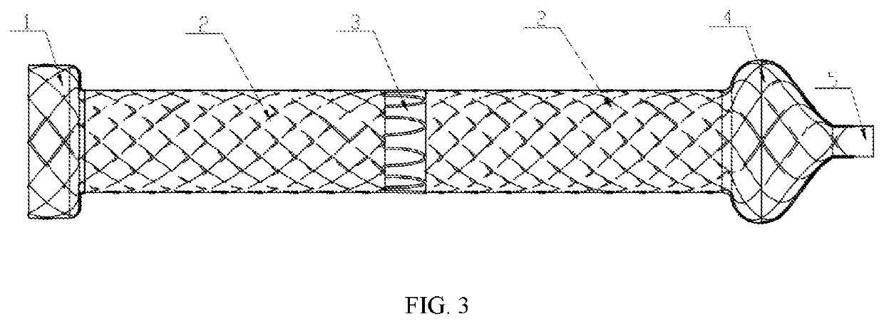 Ball-type anti-reflux biliary stent