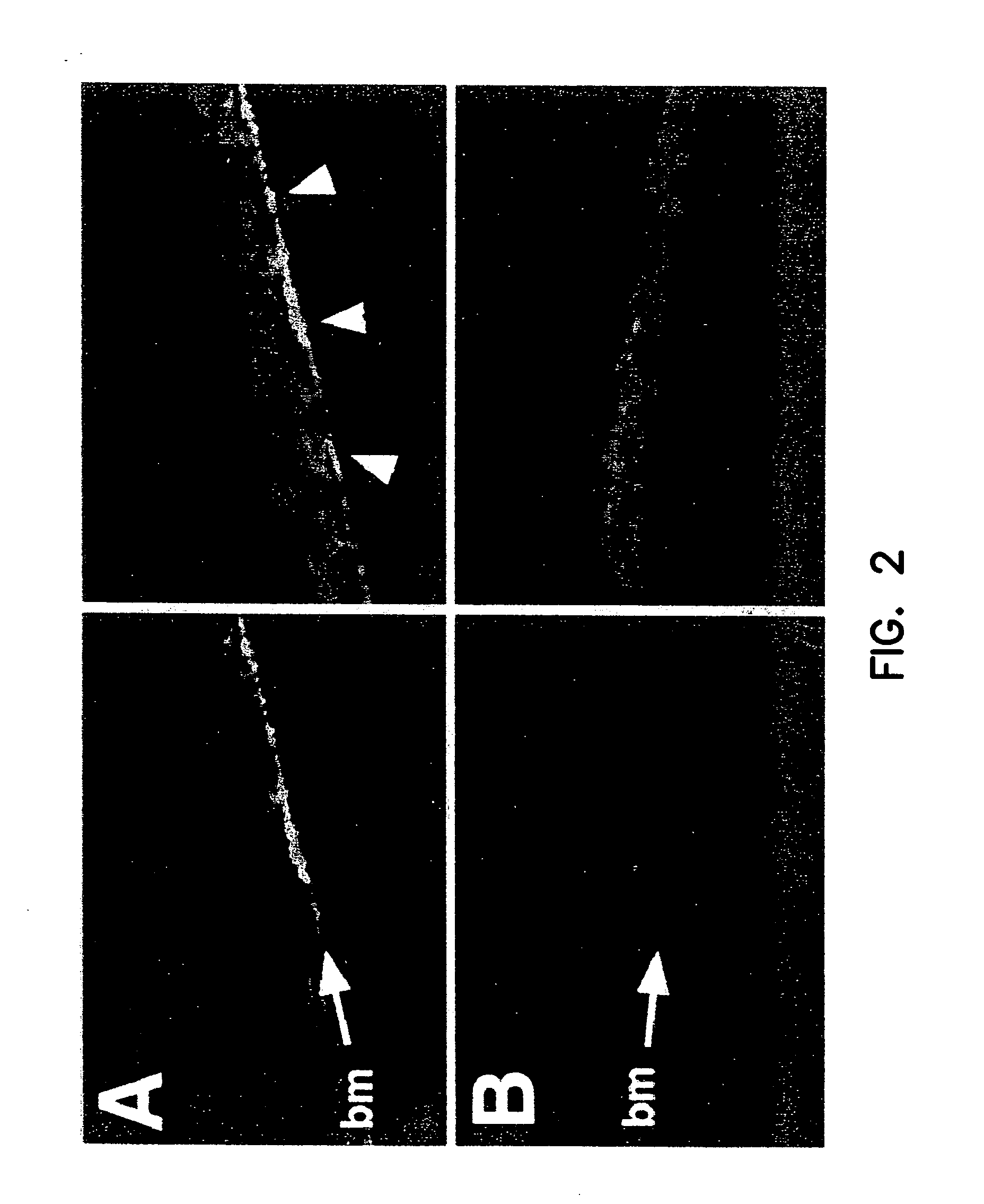 Compounds and methods to enhance rAAV transduction
