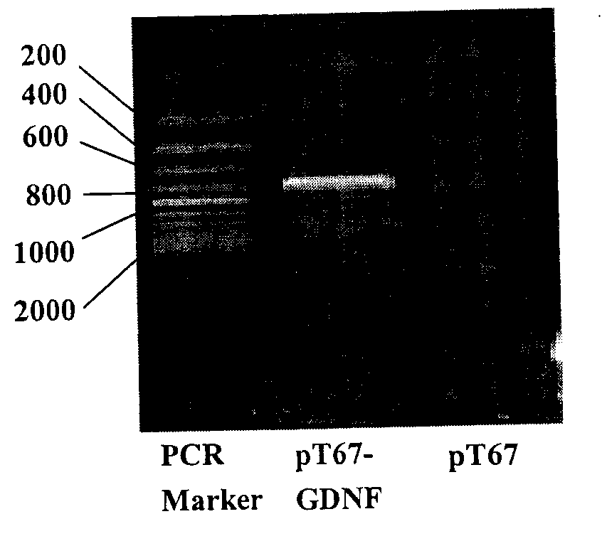 Construction method of glial cell line-derived neurotrophic factor gene-modified embryo neural stem cell