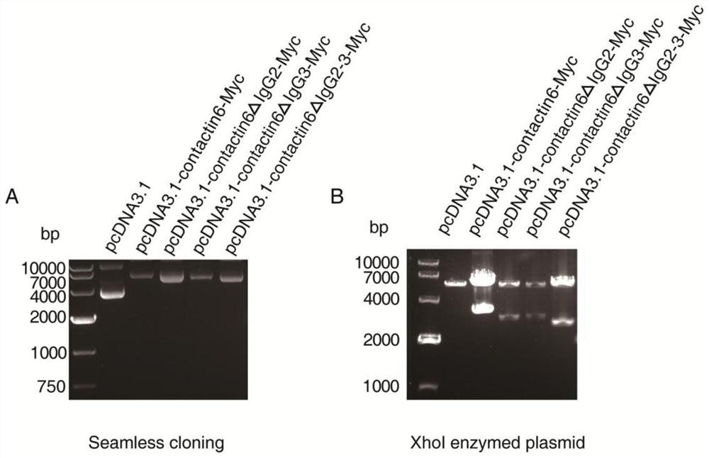 Contactin 6 protein mutant as well as coding gene, expression vector and application thereof