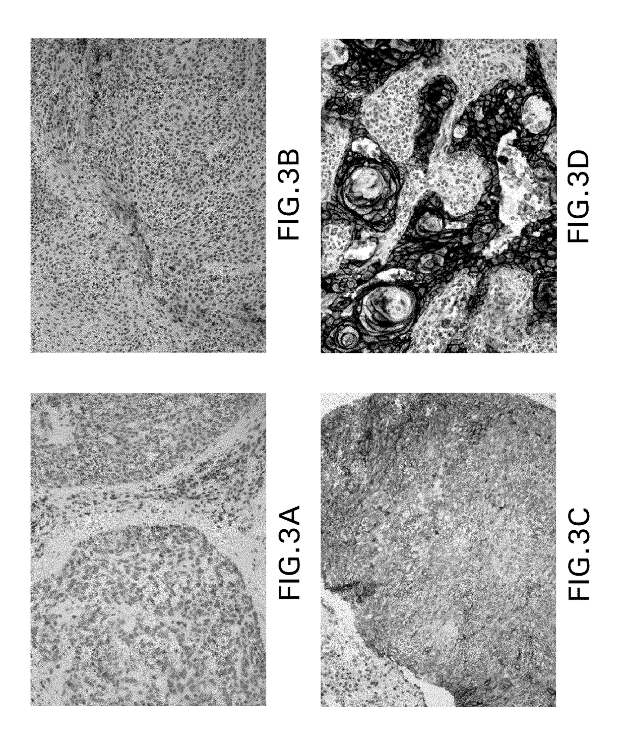 Immunohistochemical assay for detecting expression of programmed death ligand 1 (pd-l1) in tumor tissue