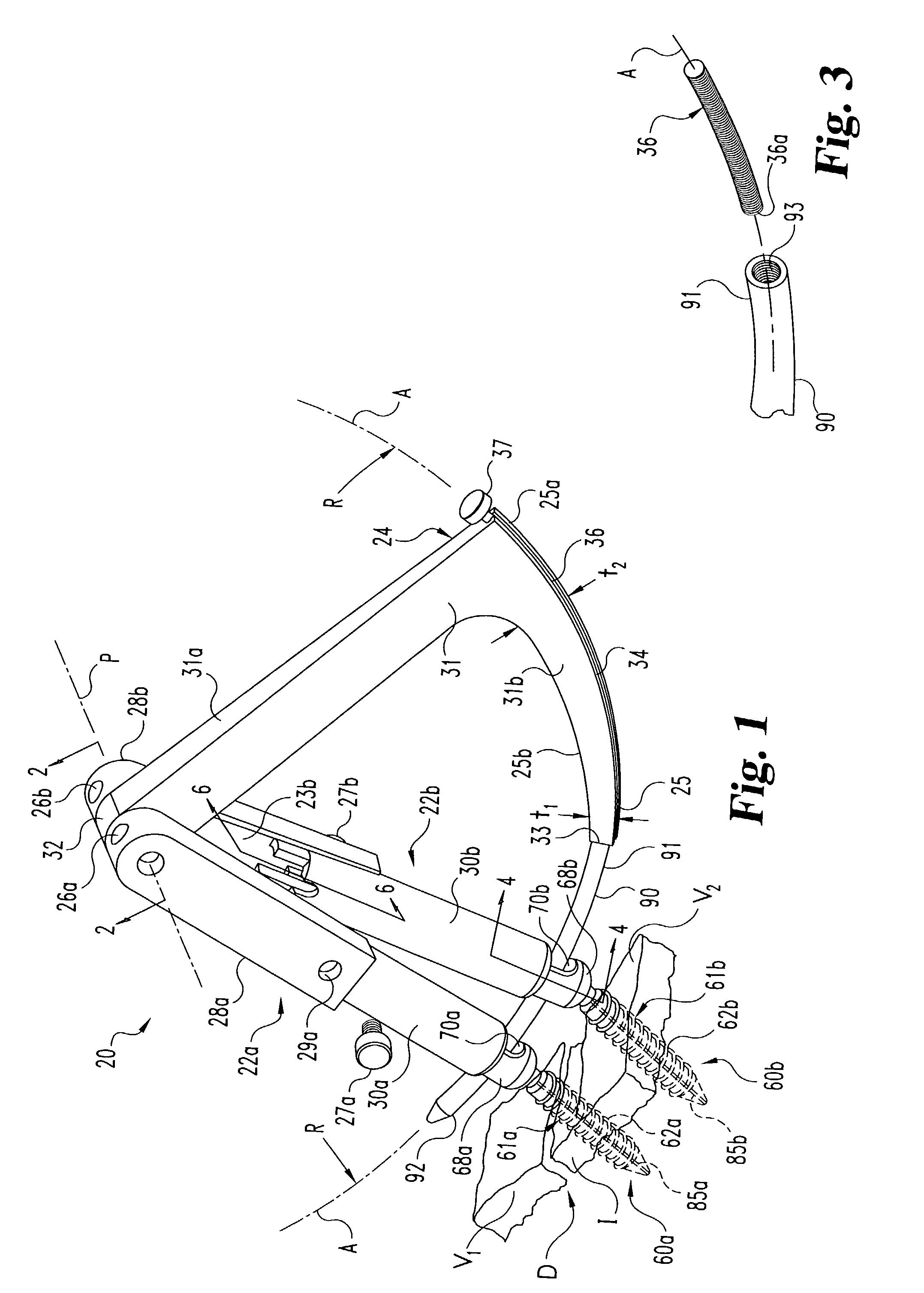 Instruments and methods for stabilization of bony structures