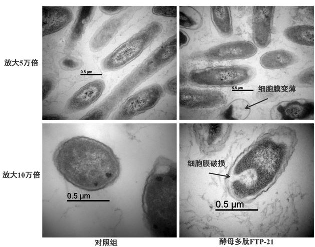 Saccharomyces polypeptide derived from saccharomyces cerevisiae var. boulardii, preparation method for saccharomyces polypeptide and application of saccharomyces polypeptide