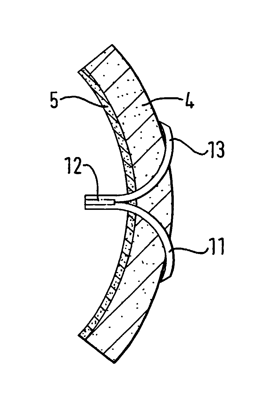 Device for the repair of arteries