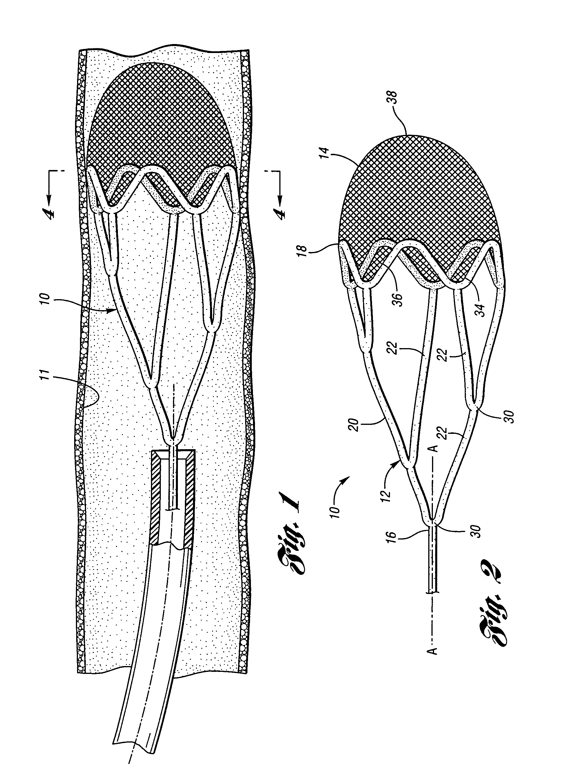 Embolic protection device having a reticulated body with staggered struts