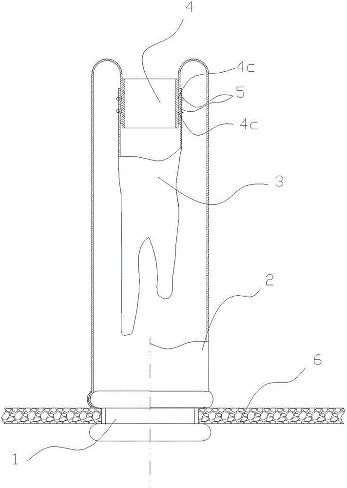 Long sleeve type hand-assisted device