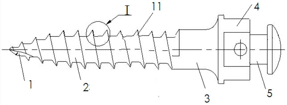 A kind of micro-anchor nail and correction device containing the micro-anchor nail