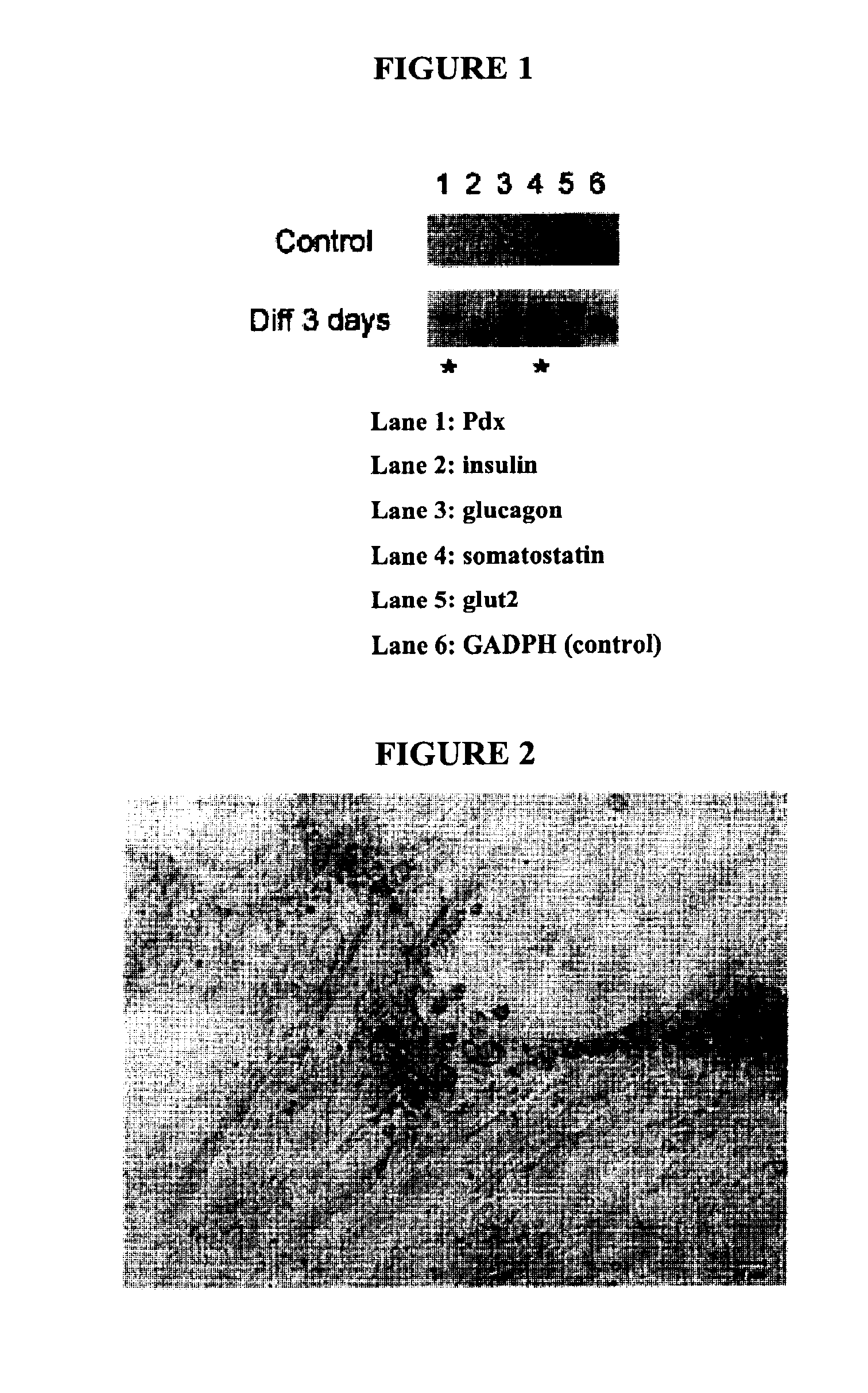 Method of differentiating mammalian progenitor cells into insulin producing pancreatic islet cells