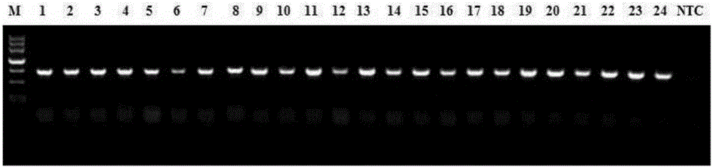 Taq DNA polymerase, and PCR (polymerase chain reaction) fluid and application thereof