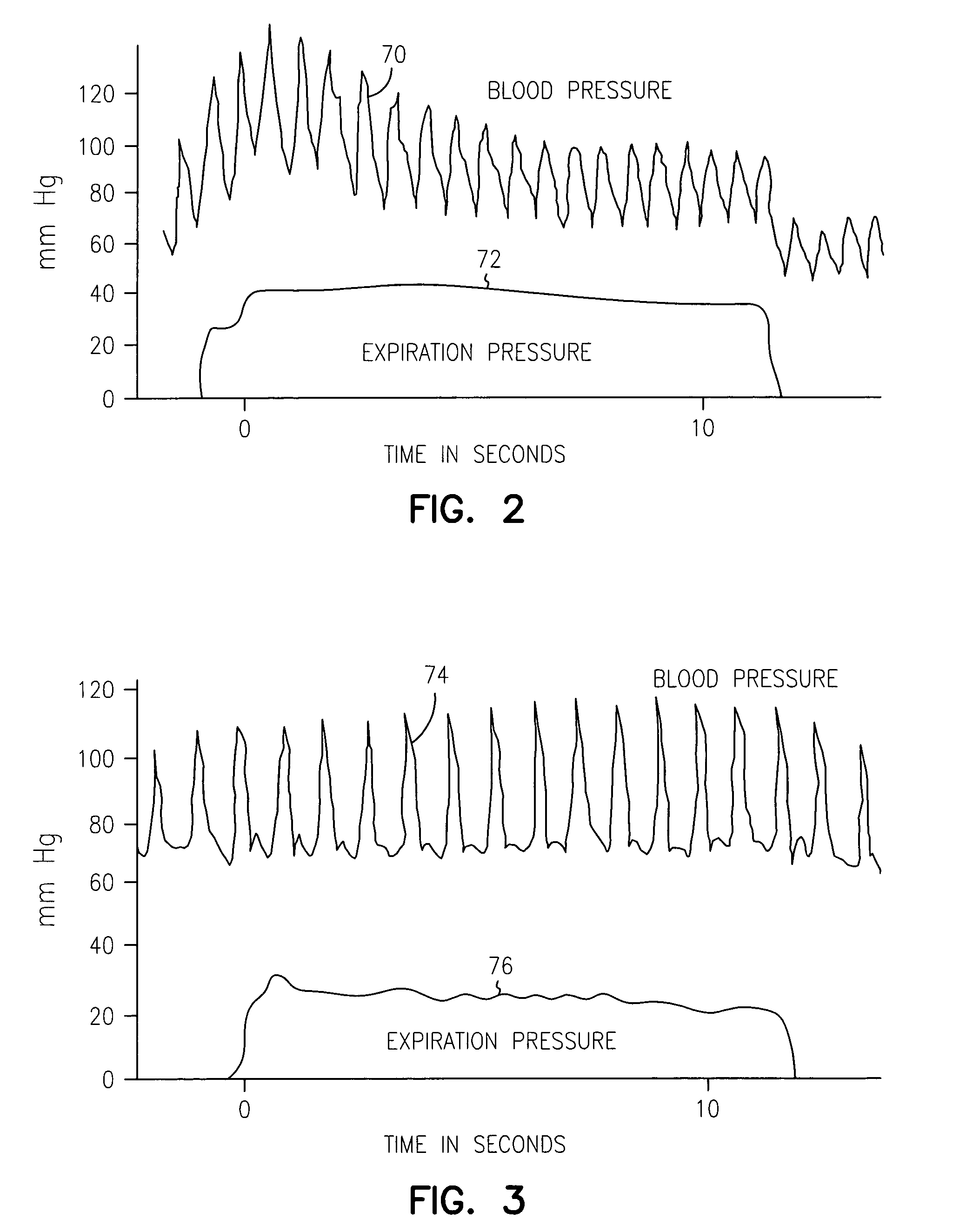 Non-invasive method and apparatus for cardiac pacemaker pacing parameter optimization and monitoring of cardiac dysfunction