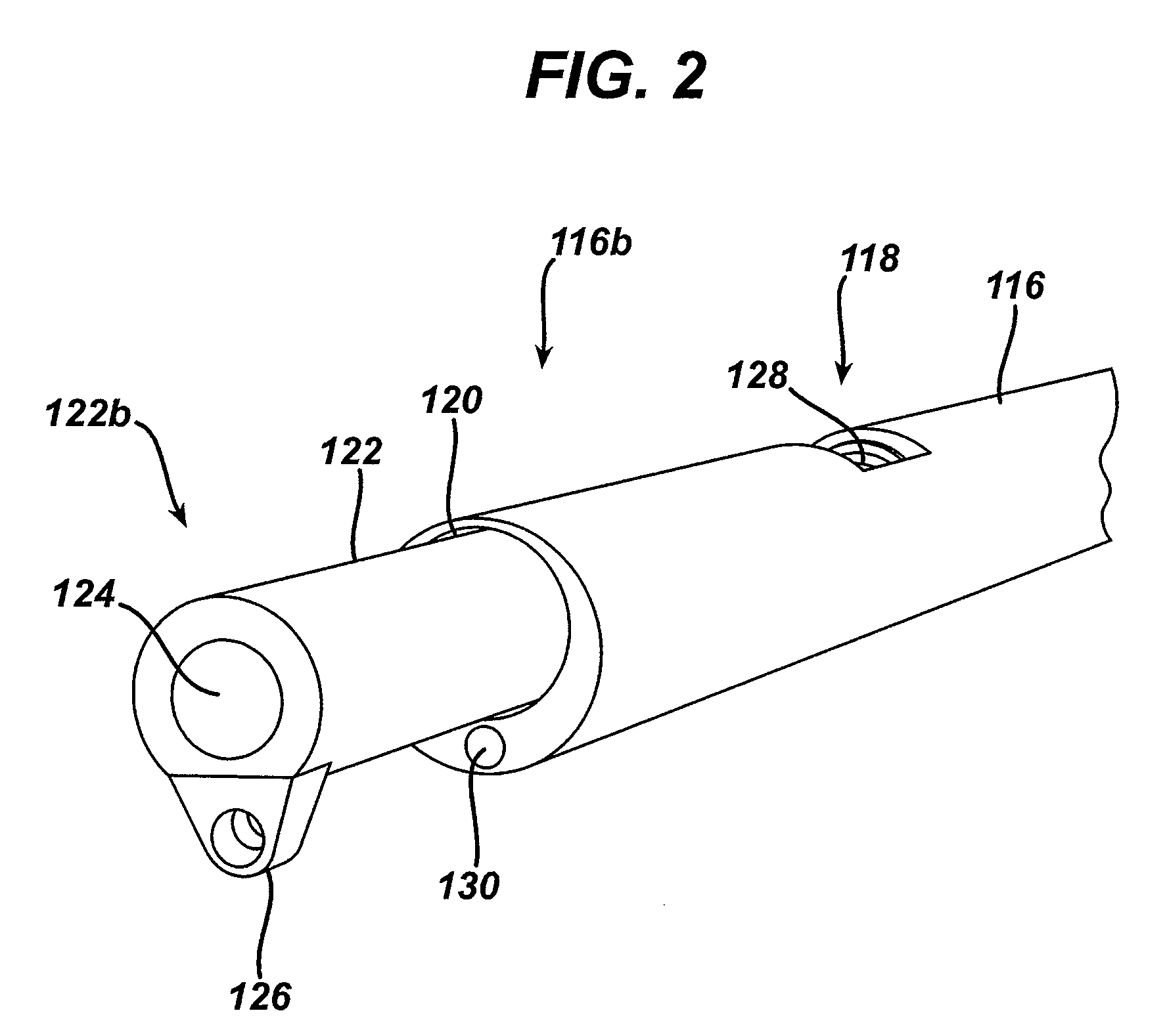 Endoscopic Tissue Resection Device