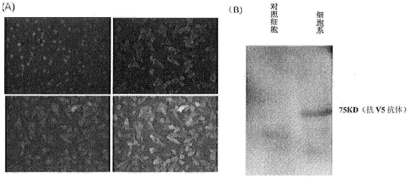 Preparation method of human-infected TRIM25 gene foot and mouth disease virus inhibiting cell line and application thereof