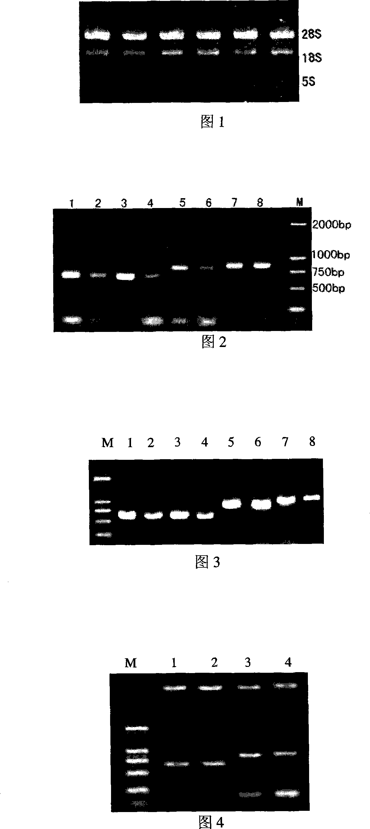 Representation method for recombinant american cockroaches allergen protein