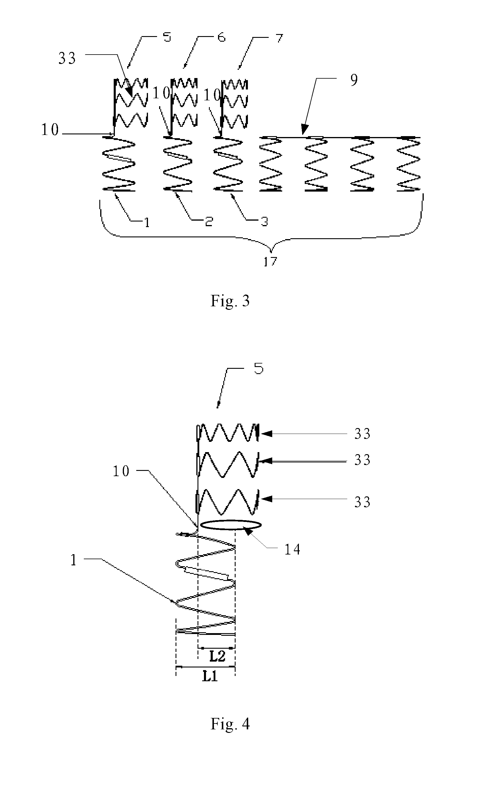 Aortic Arch Intraoperative Stent and Manufacturing Method Thereof