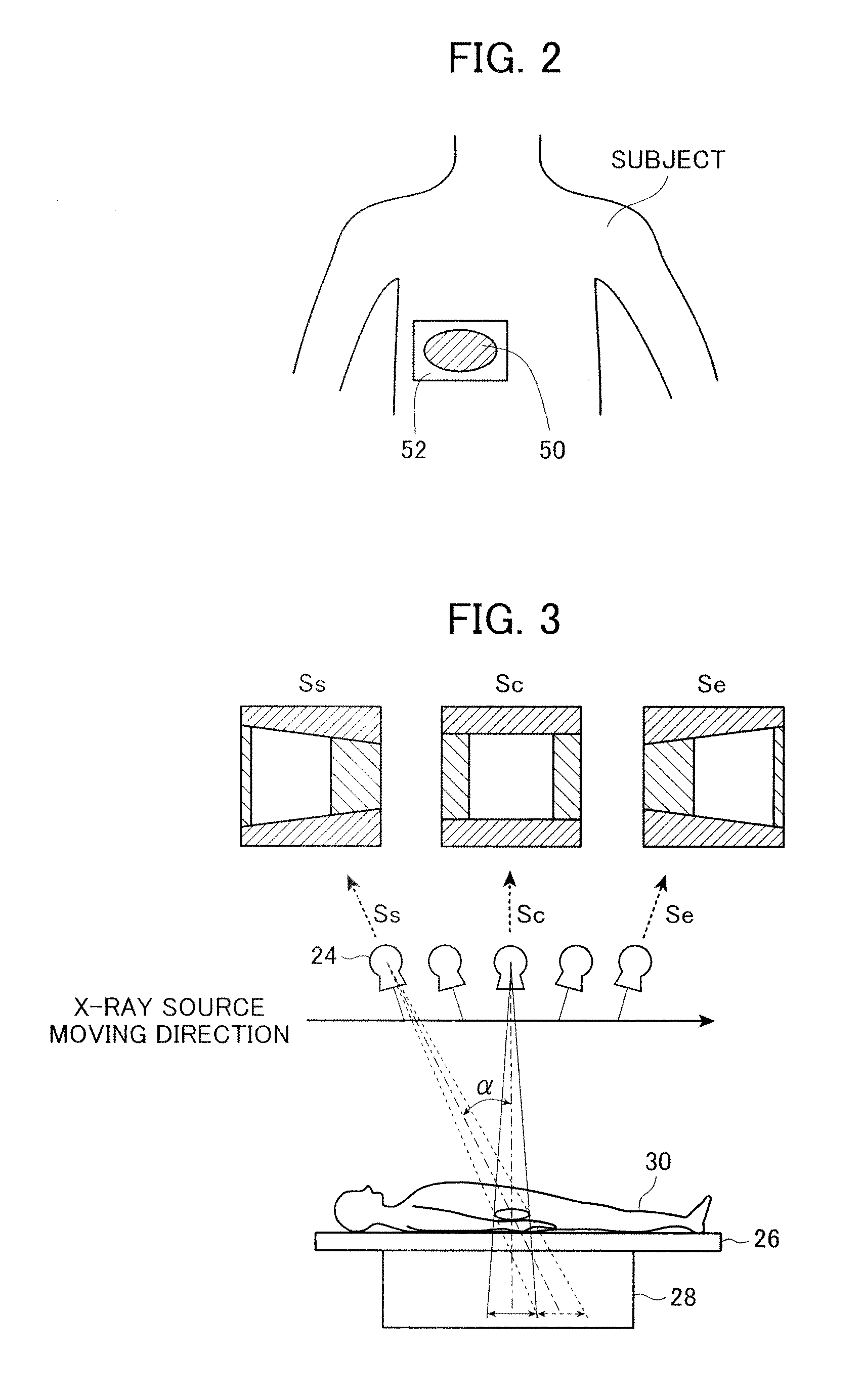X-ray imaging system and x-ray imaging method