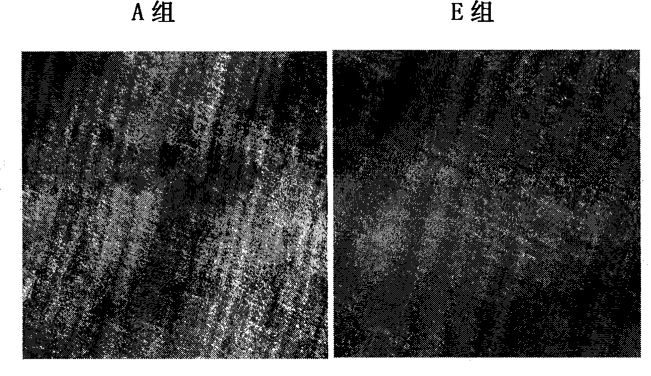 Mesenchyma stem cell for inhibiting osteoclast generation, as well as preparation method and application thereof