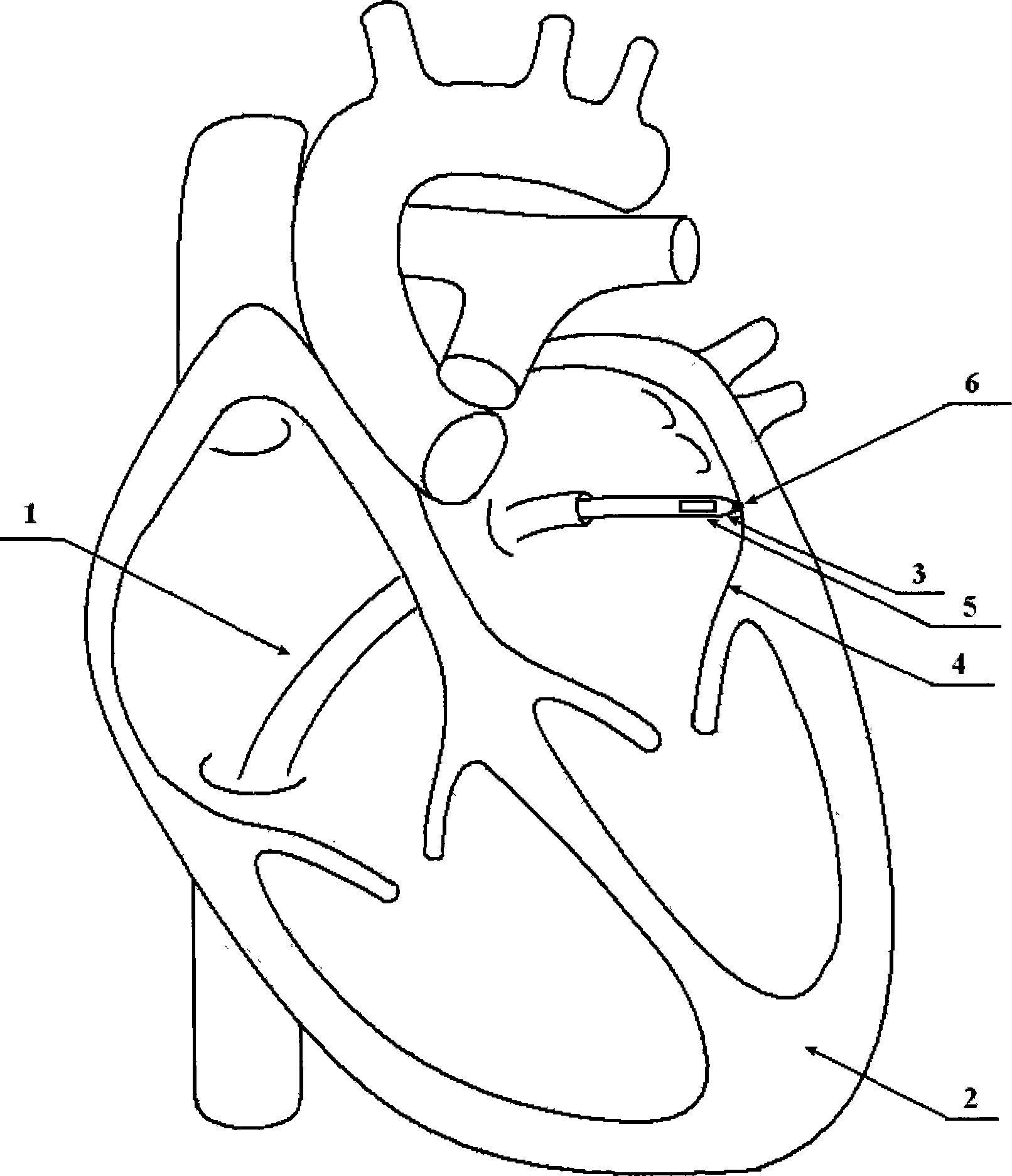 Human body organ three-dimensional surface rebuilding method and system
