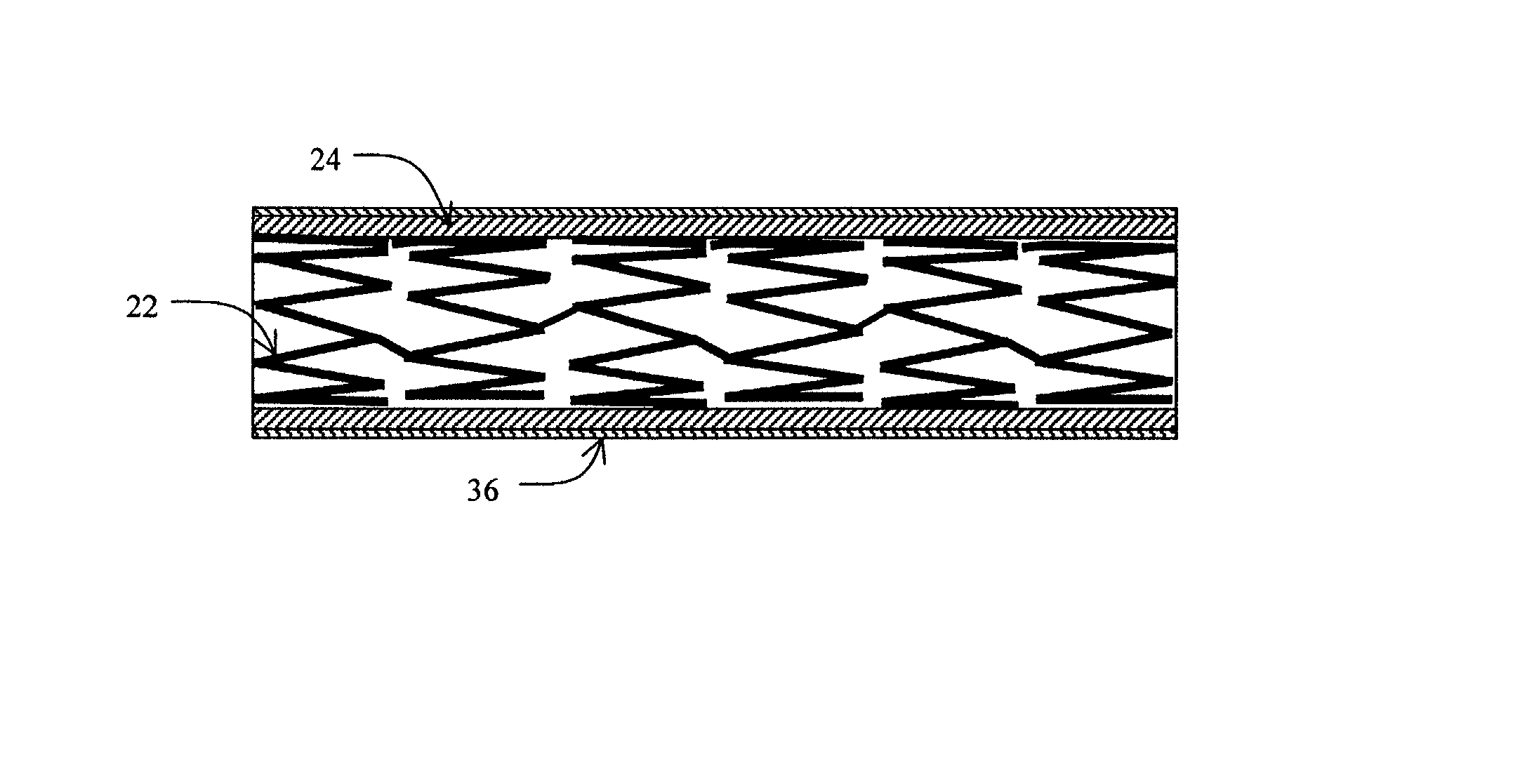 Stent having cover with drug delivery capability