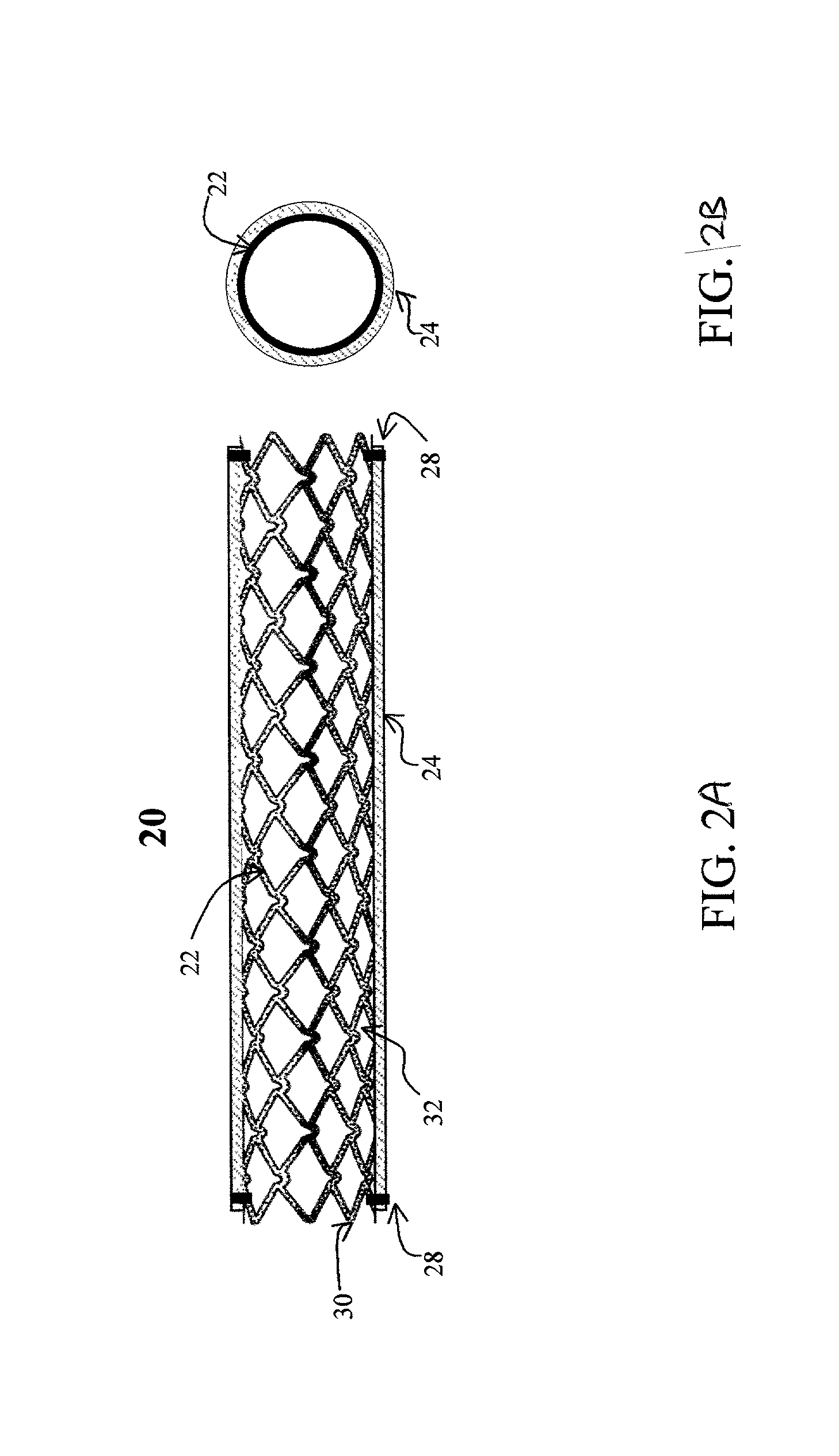 Stent having cover with drug delivery capability