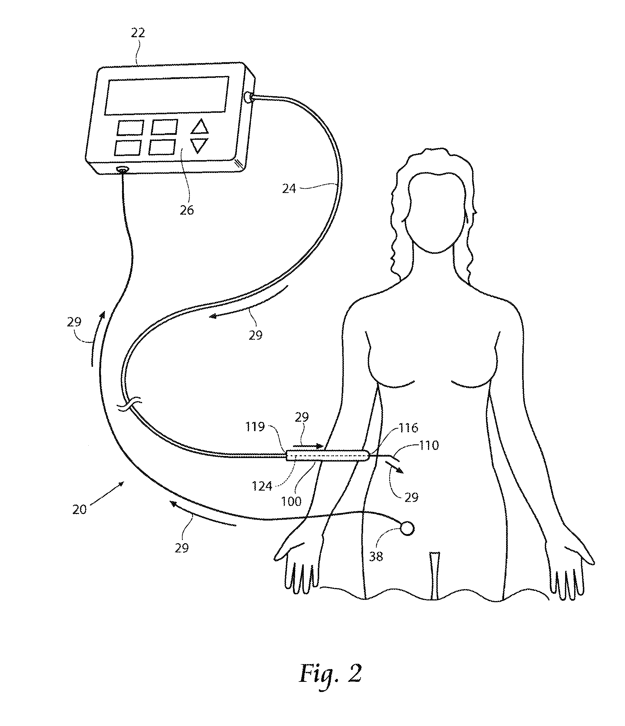 Stimulation device adapter