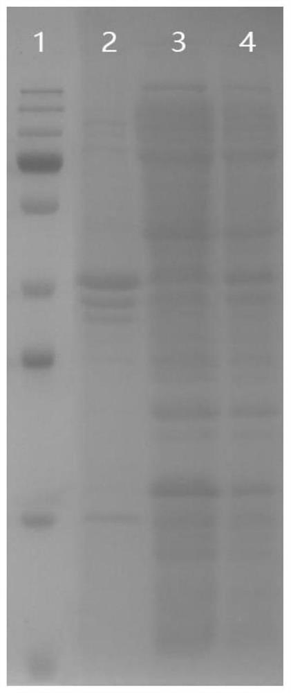 Group b Neisseria meningitidis recombinant pili protein fim and its preparation method and application