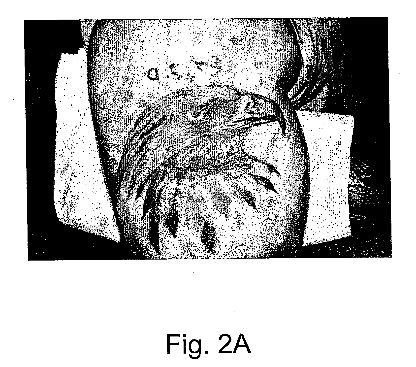 Method for removing pigments from a pigmented section of skin