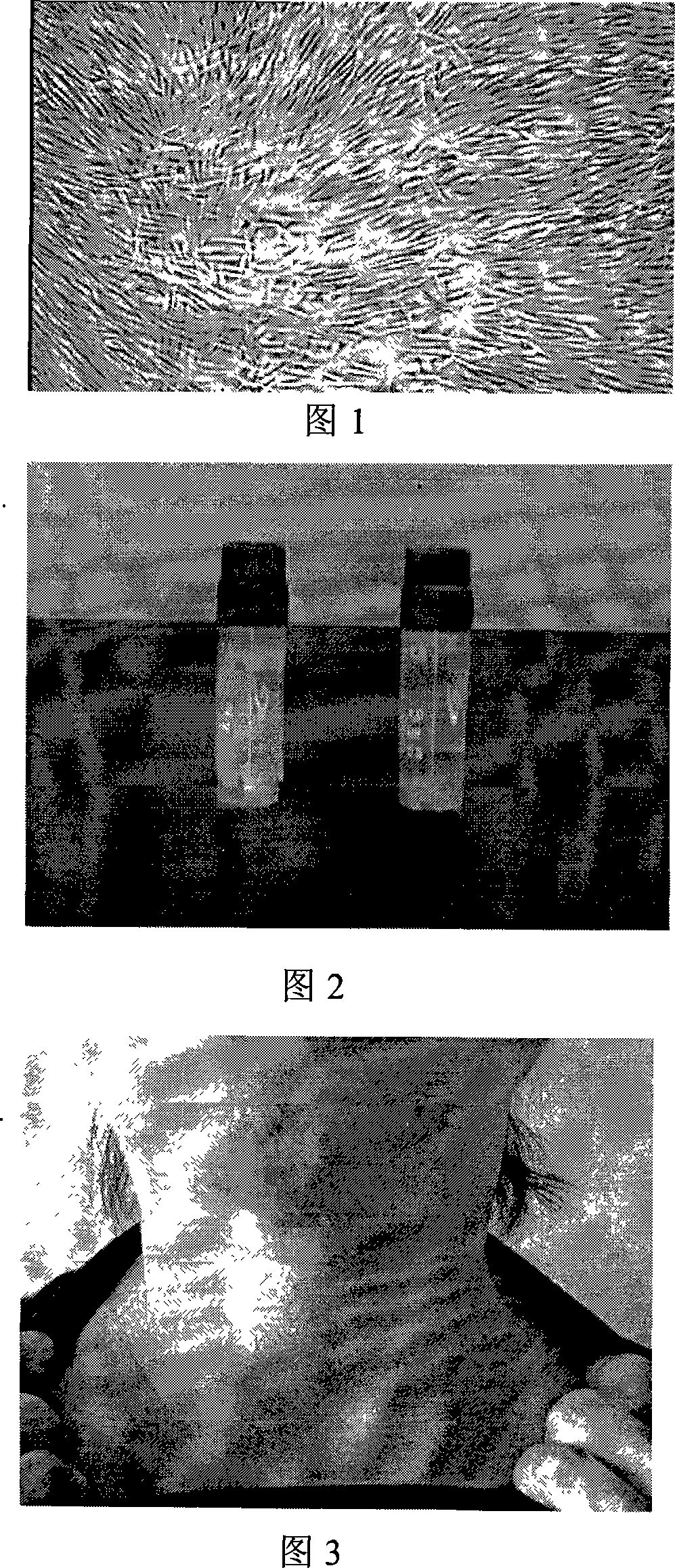 Human skin filler for injection and its prepn process