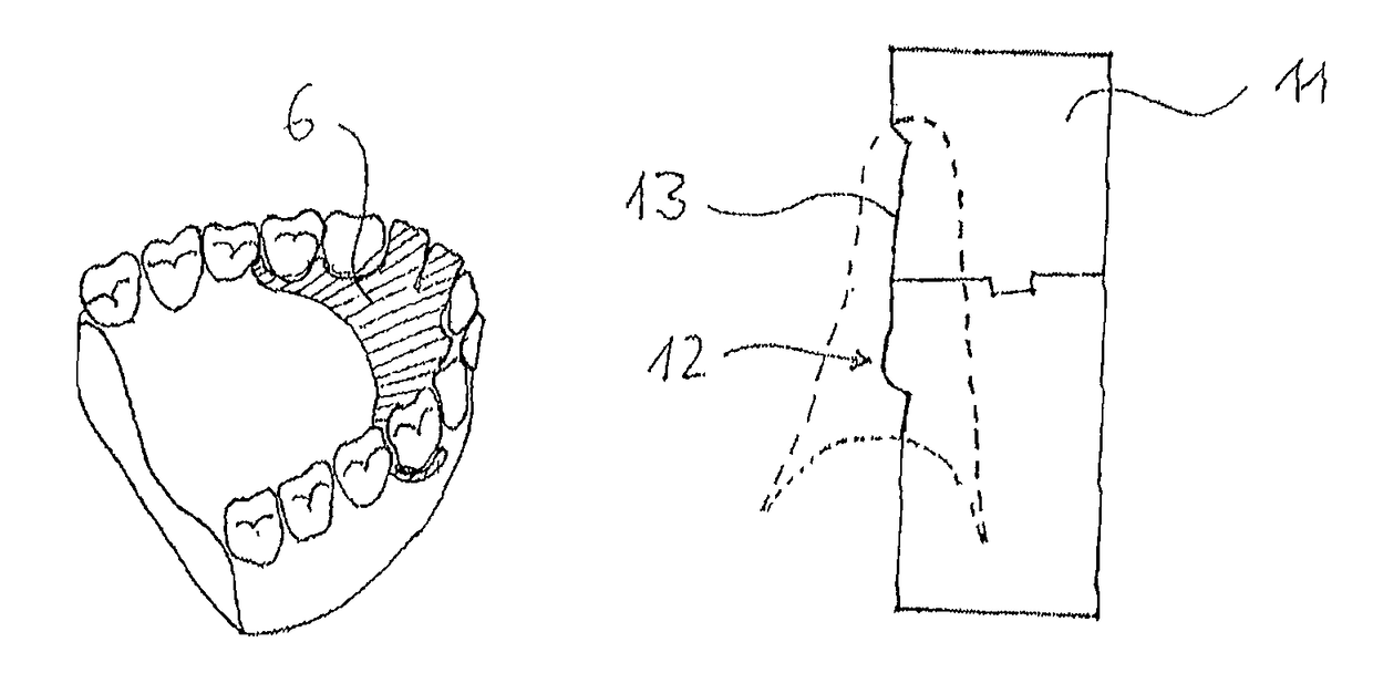 Method for generating a model of a dental replacement part