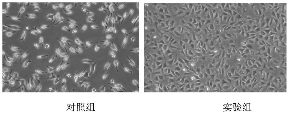 Recombinant human collagen, coding gene and application of recombinant human collagen to preparation of repair dressing