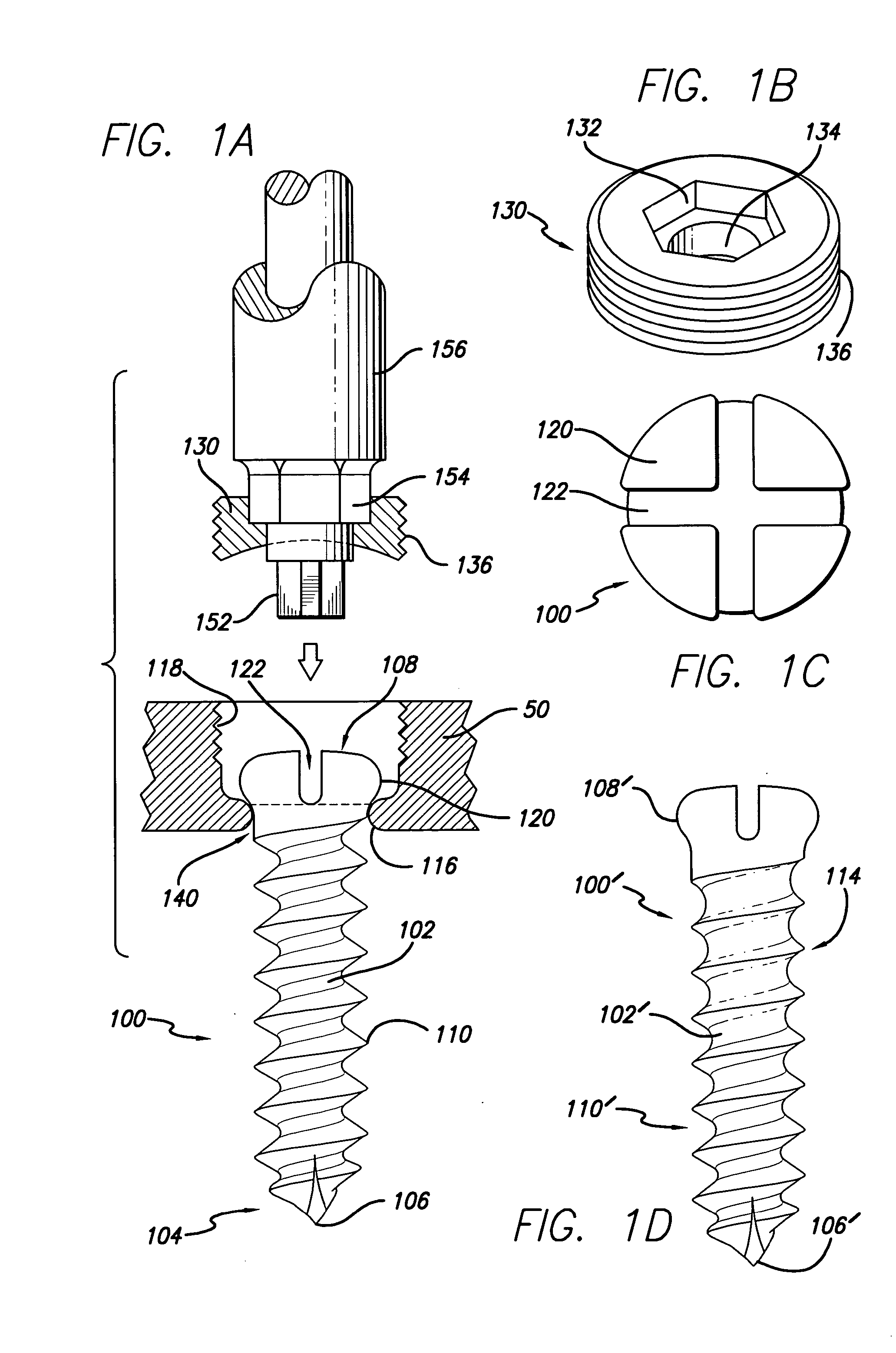 Implant having upper and lower extended members and method for use thereof