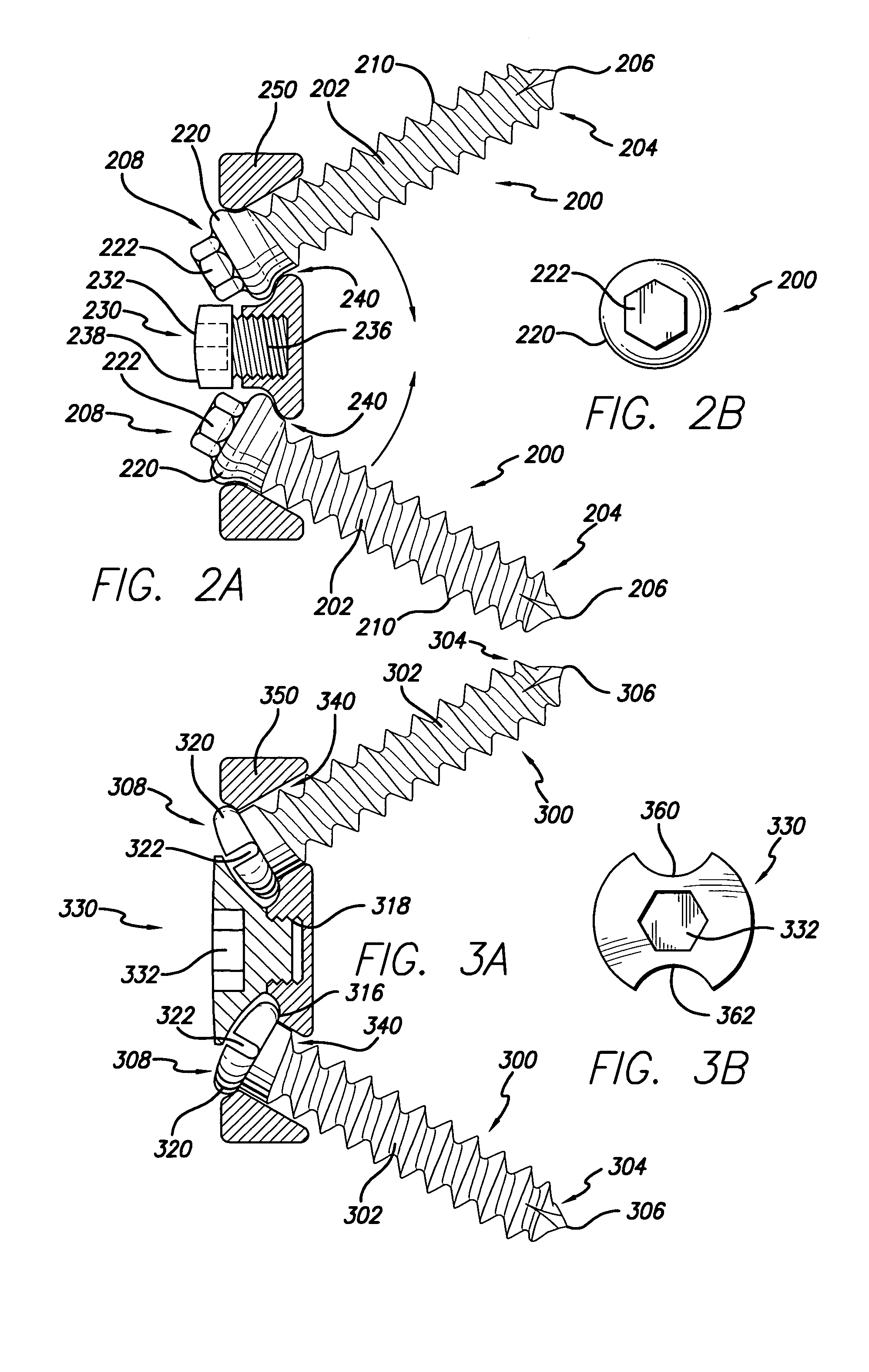 Implant having upper and lower extended members and method for use thereof