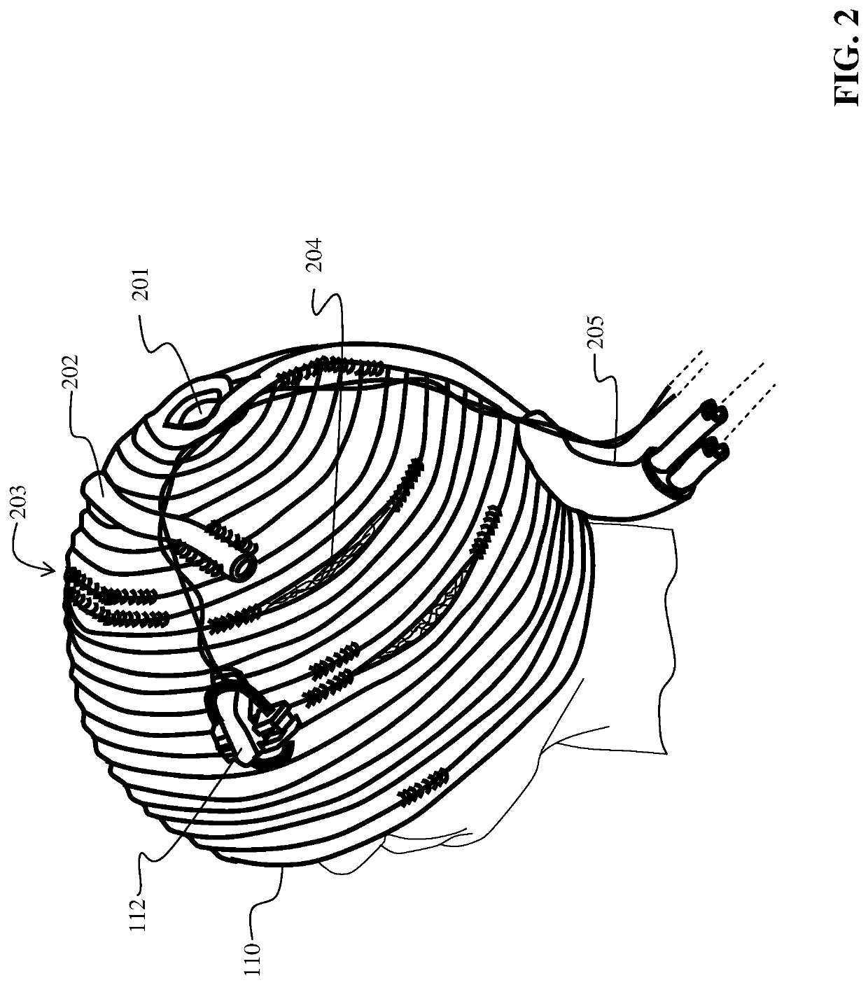 Method and apparatus of a self-managed portable hypothermia system