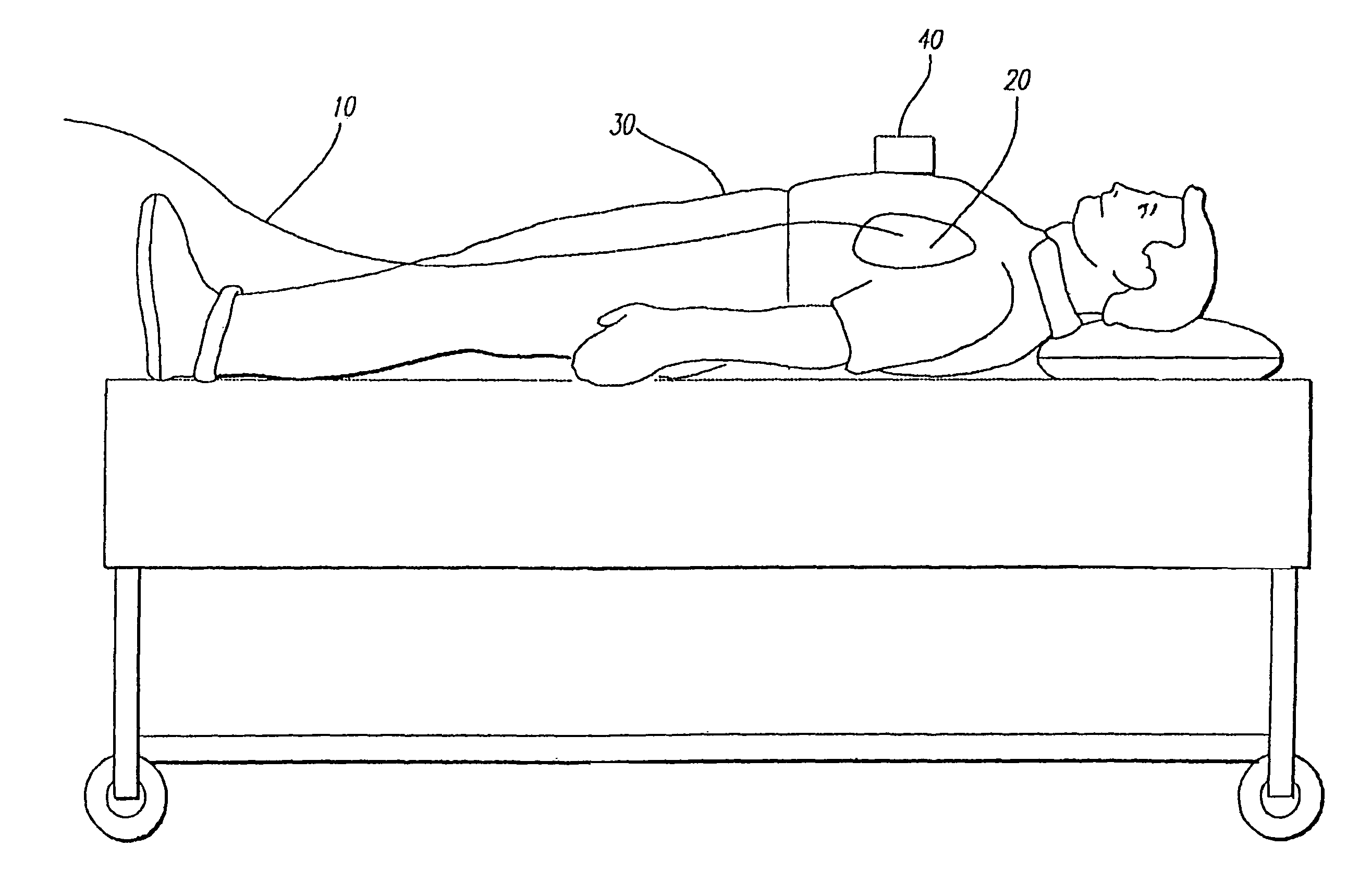 Apparatus and method for inducing vibrations in a living body