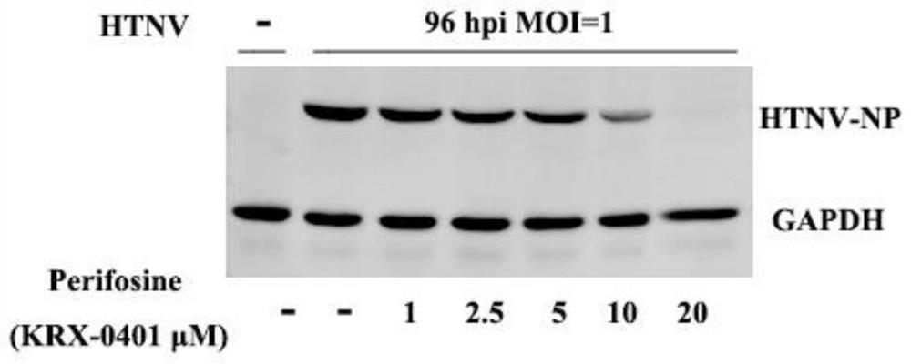 Application of Perifosine to preparation of anti-Hantaan virus drug