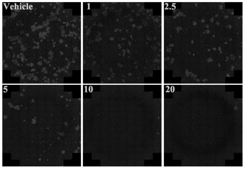 Application of Perifosine to preparation of anti-Hantaan virus drug