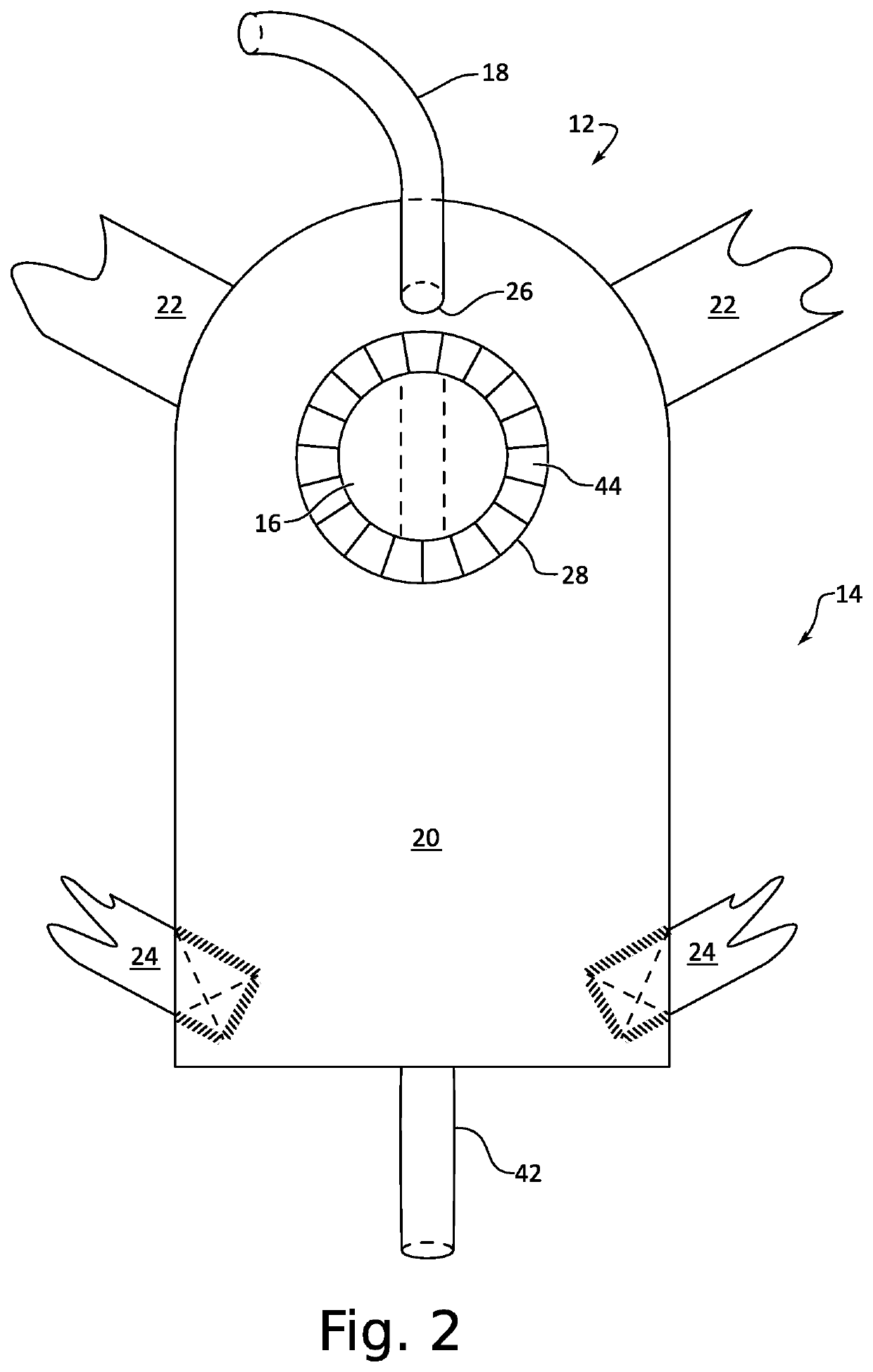 External catheter