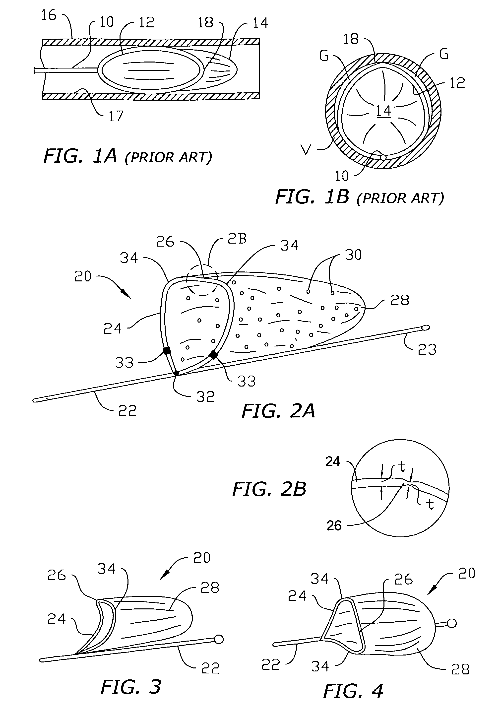 Vascular device for emboli, thrombus and foreign body removal and methods of use