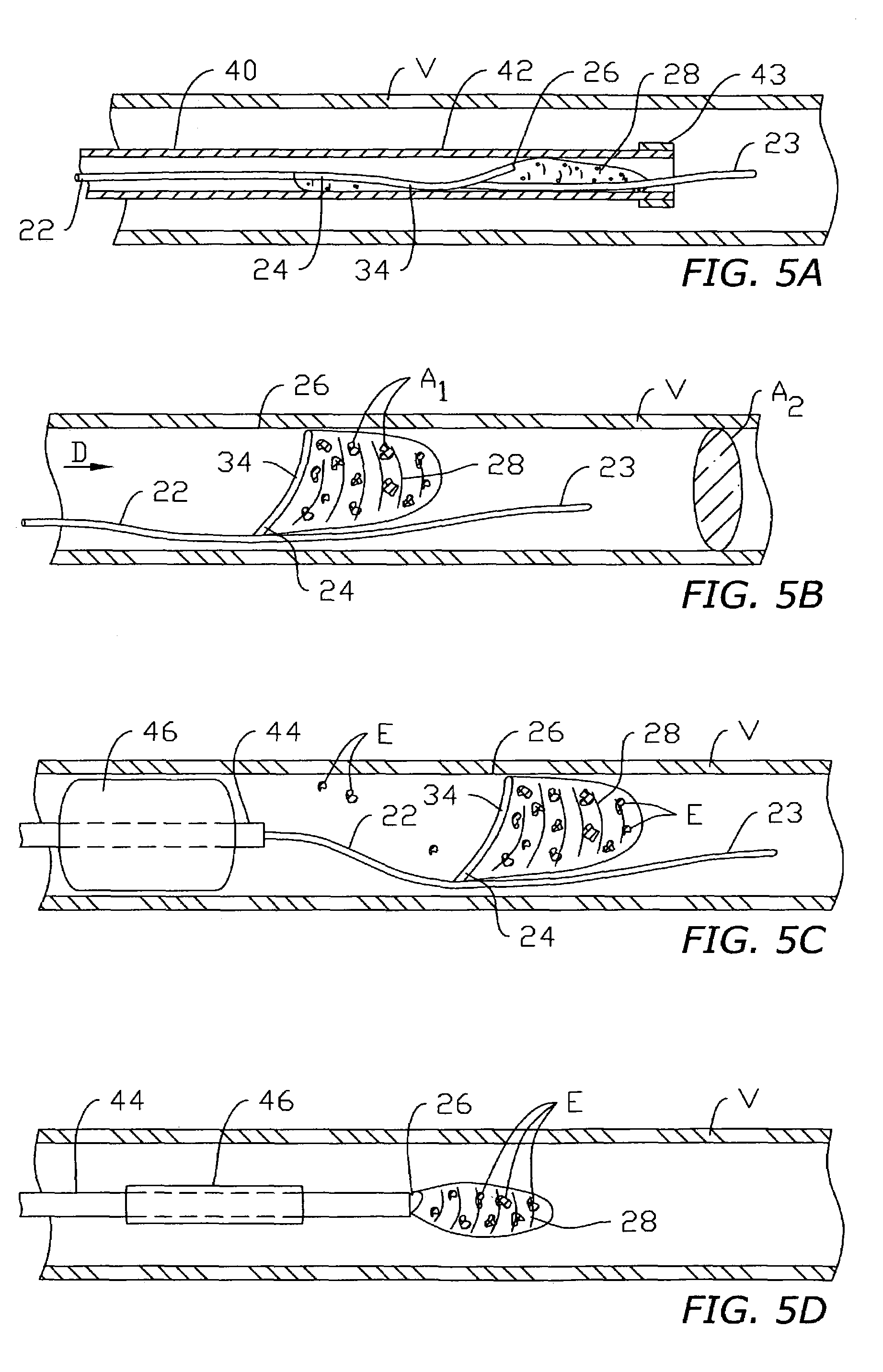 Vascular device for emboli, thrombus and foreign body removal and methods of use