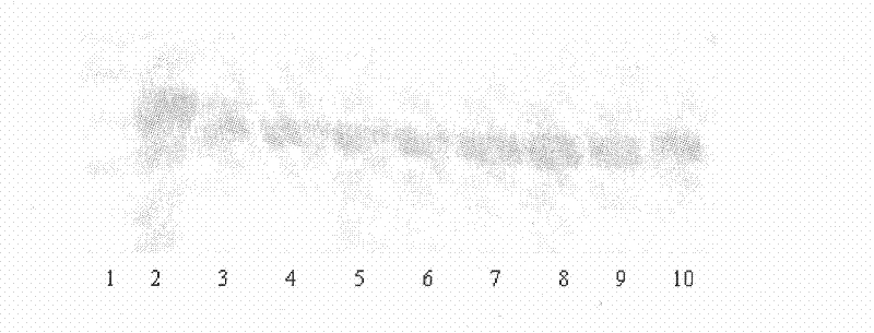 Protease, preparation method of same, as well as application and pharmaceutical formulation thereof