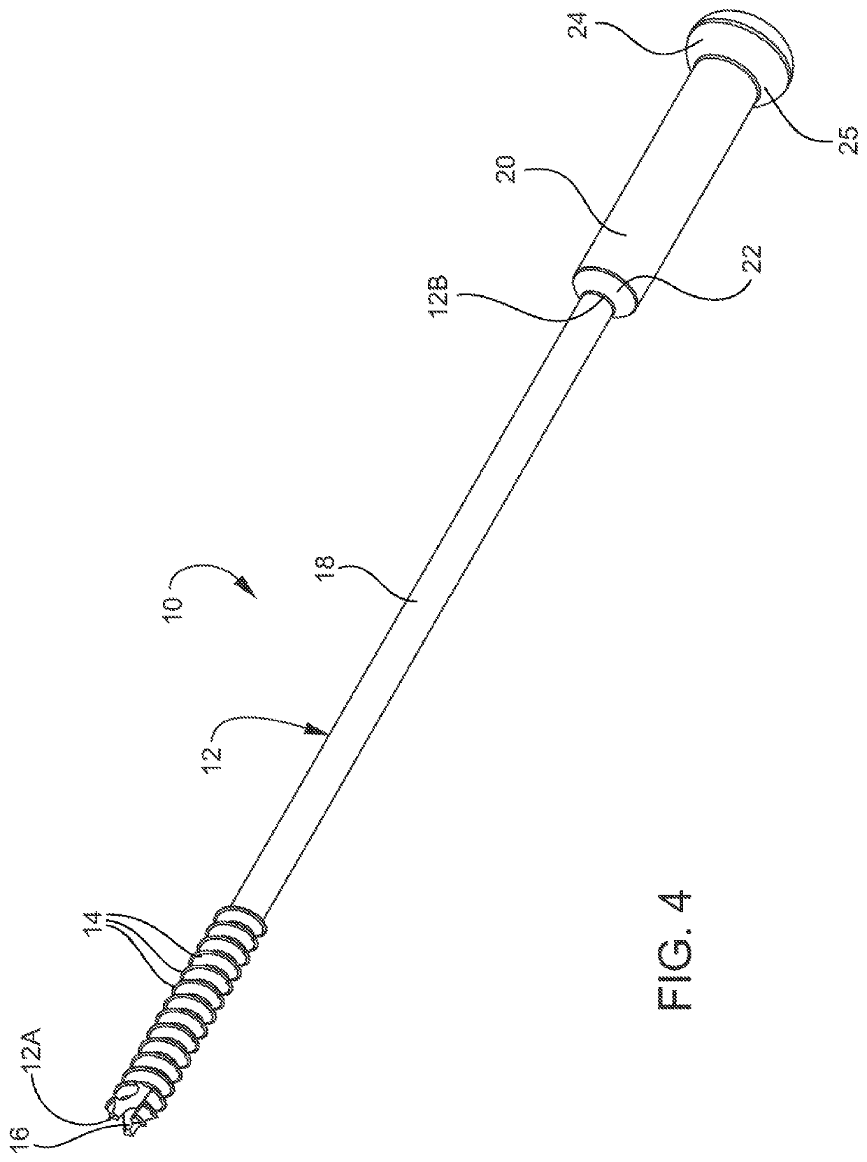 Cannulated orthopedic screw and method of reducing a fracture of the lateral malleolus