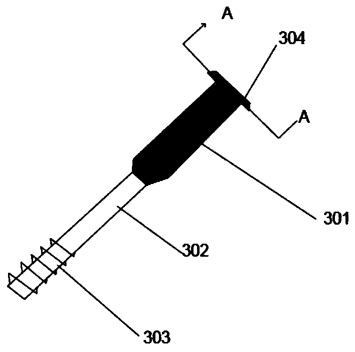 Femoral intramedullary distributed anti-rotation fixing device