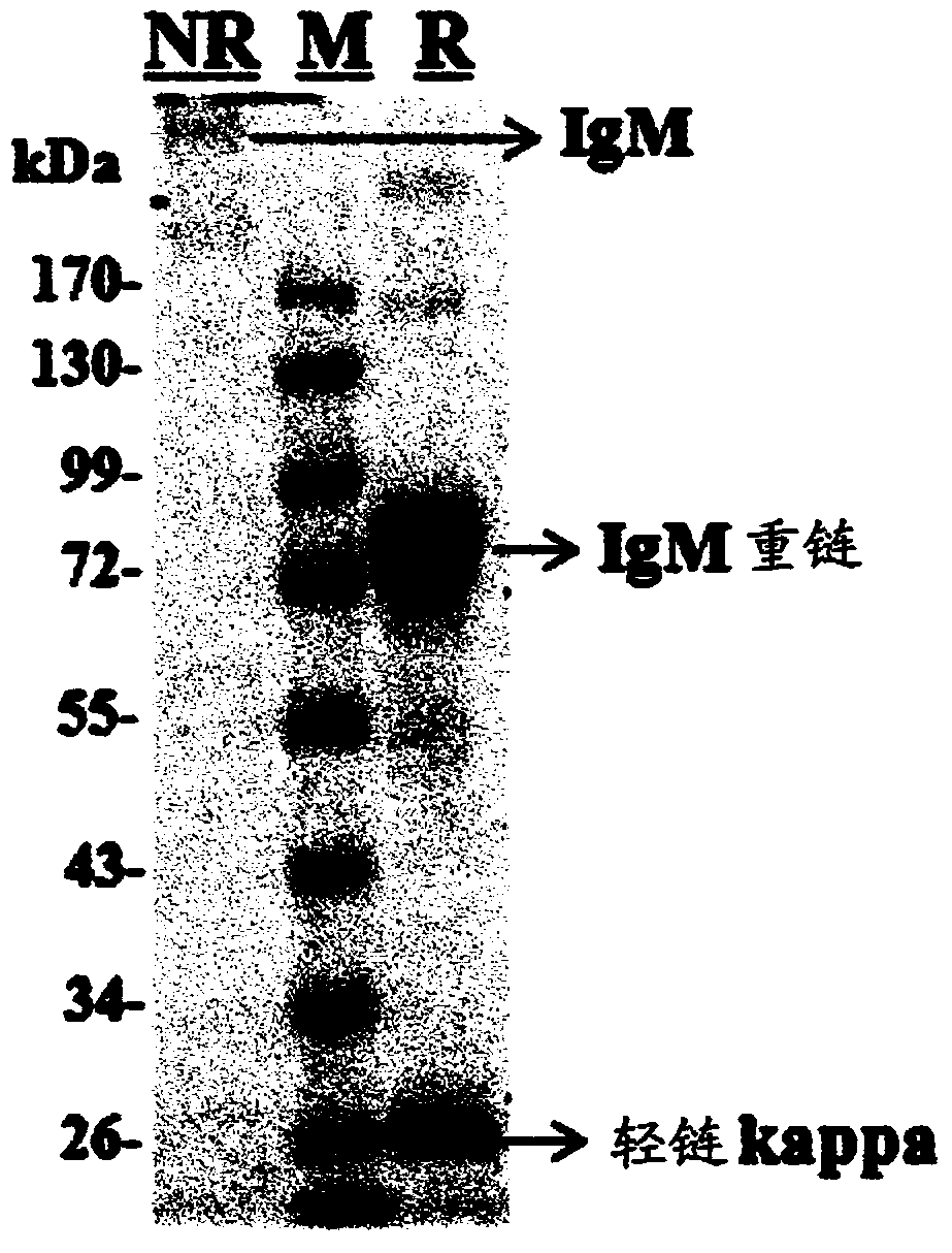 A marker comprising anti-CK8/18 complex autoantibody and its use for diagnosing cancer