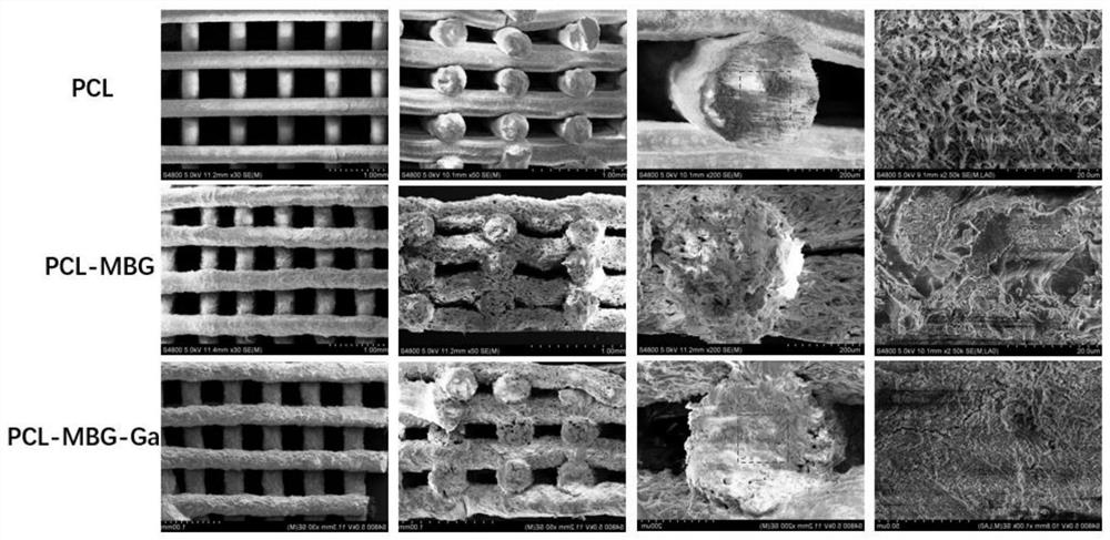 Gallium-containing polycaprolactone/bioglass porous bone repair 3D printed scaffold and its application in the repair of infected bone defects