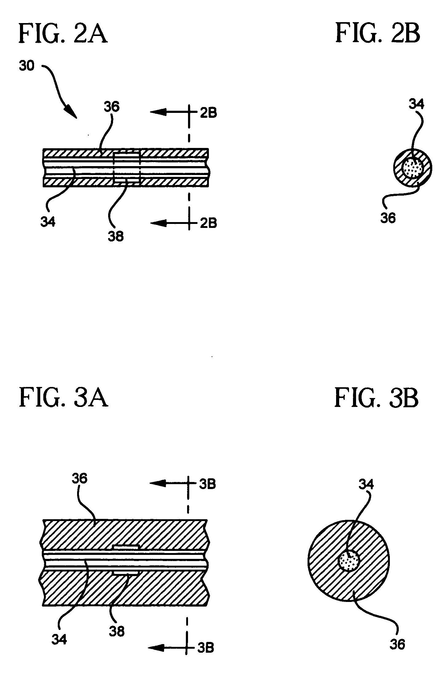 Methods of, and materials for, treating vascular defects with magnetically controllable hydrogels