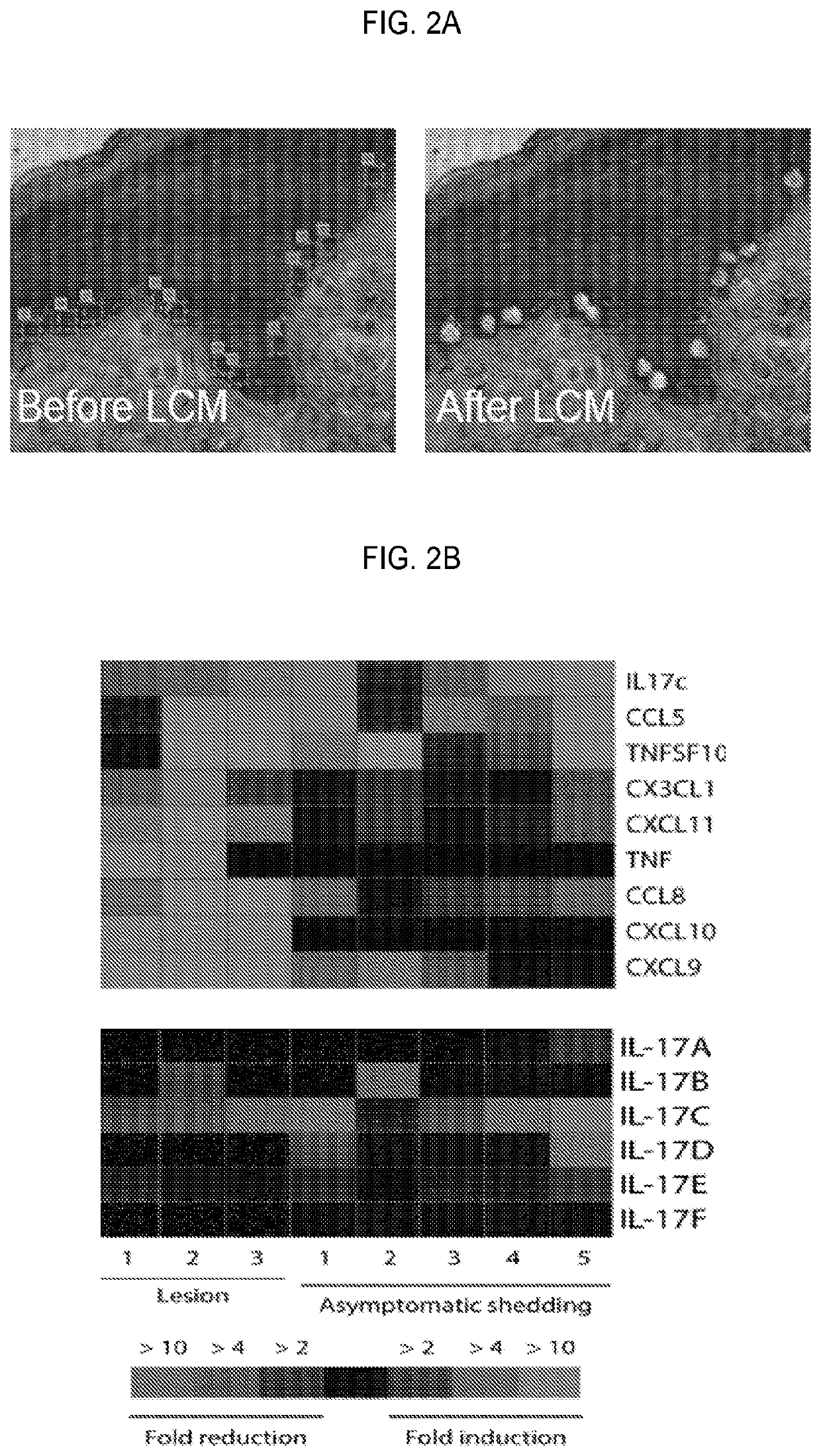 Compositions, kits, and methods using interleukin-17C to promote neural growth and/or neural survival