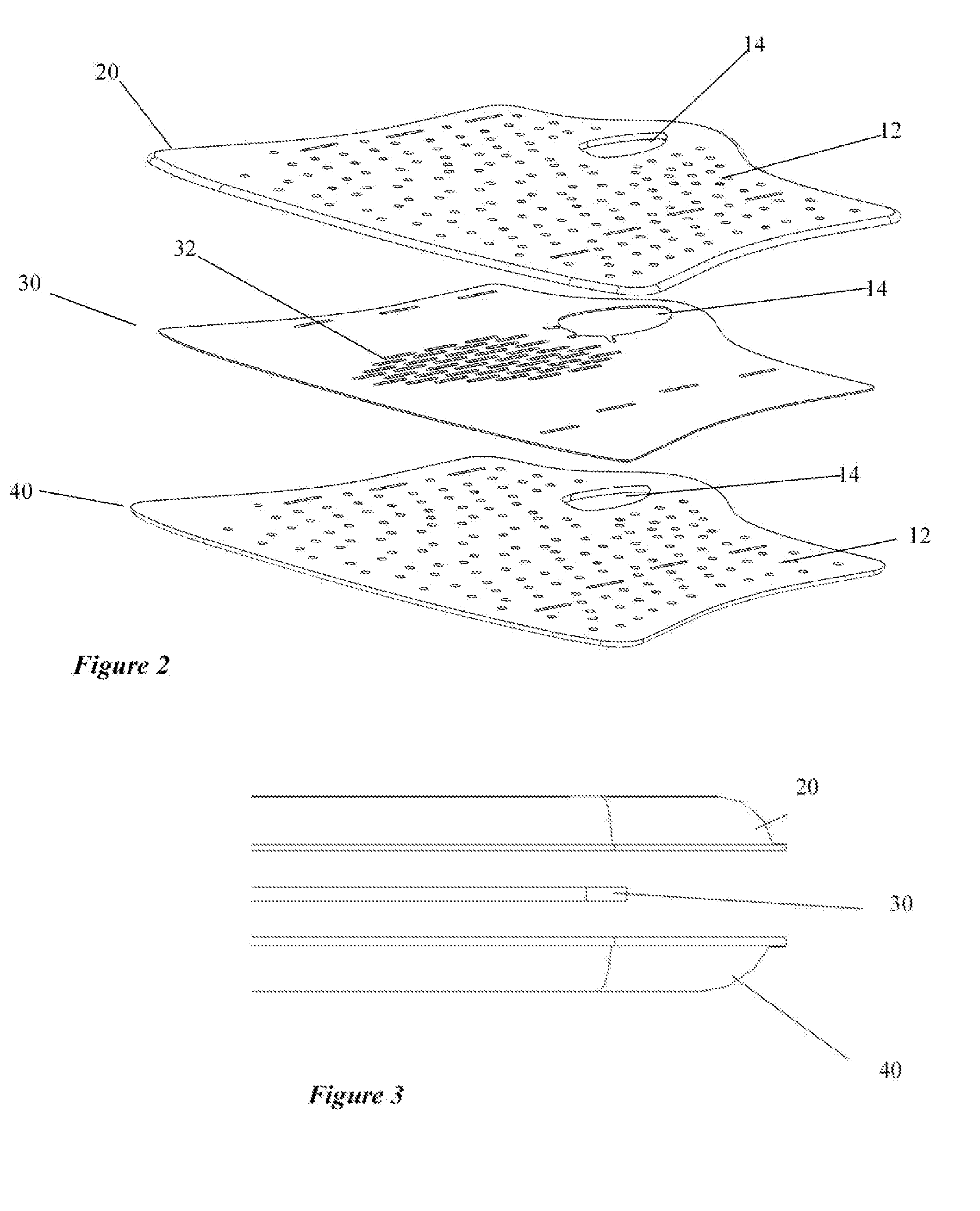 Orthopedic System for Immobilizing and Supporting Body Parts