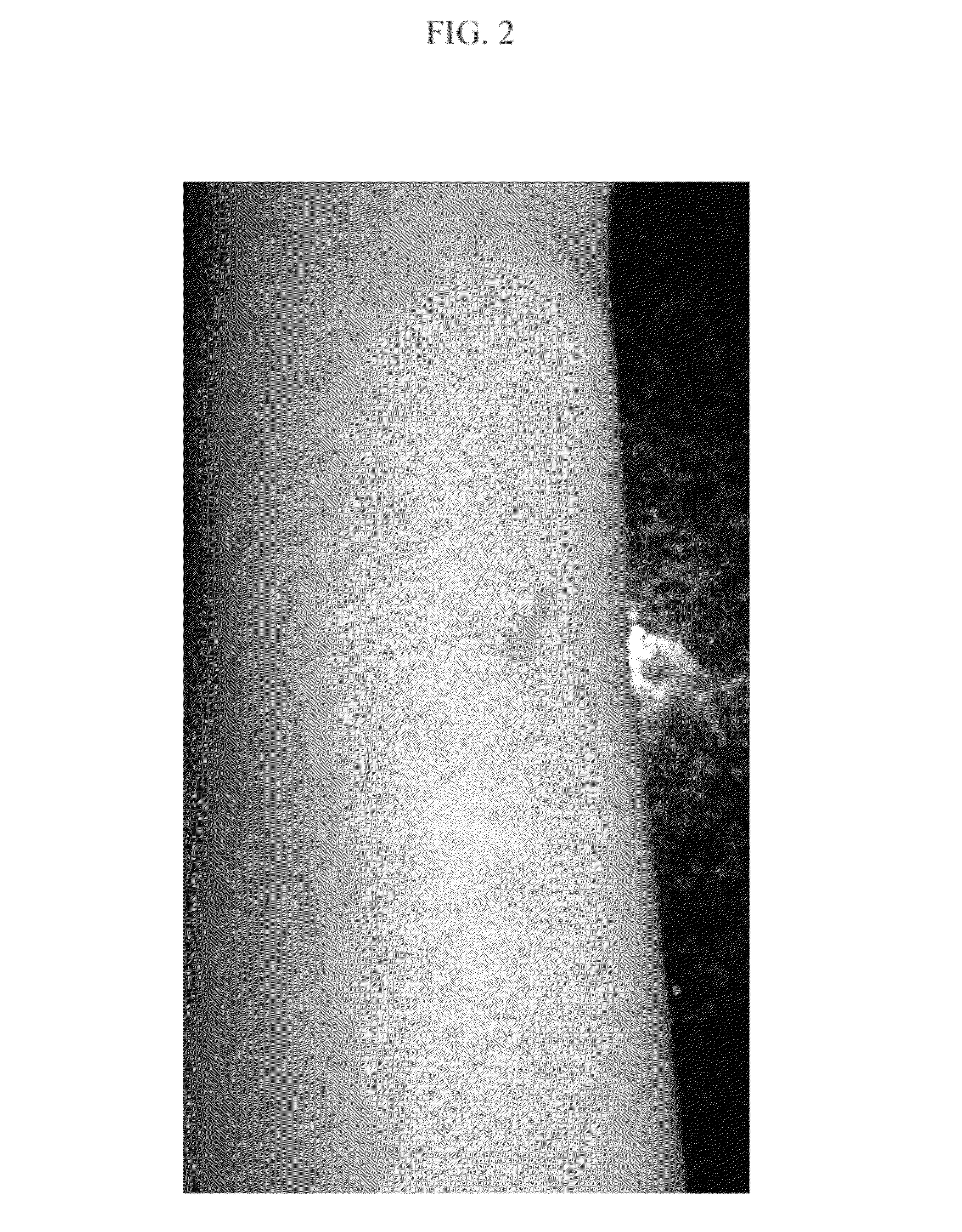 Topical base and active agent-containing compositions, and methods for improving and treating skin